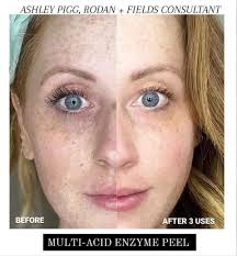 Rodan + Fields YEAR END SALE!!! Now-Dec 31! *link in bio + new customers  get an additional 15% off w/promo code WELCOME15 👌🏽👏🏼  #moneybackguarantee #dermatology #skincare #skincareroutine #skincaretips  #skincareproducts #selflove #selfcare ...