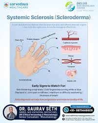 Image result for Systemic Sclerosis