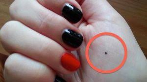 Itu dia tadi, maksud tahi lalat di muka. Cantik Dan Manis Dipandang Namun Kewujudannya Normal Atau Ini Tanda Awal Kanser