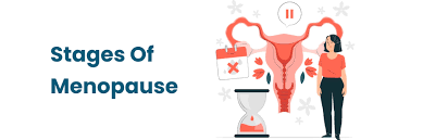 Image result for Menopause