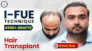 Hair Transplant in Pune