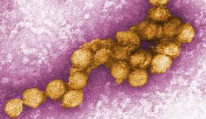 Das west nil virus bewegt sich innerhalb der vereinigten staaten allmählich richtung westen. West Nil Virus Erstmals Bei Uns Uberwintert Forscher Weisen Den Exotischen Erreger Bei Pferden Und Vogeln Im Osten Deutschlands Nach Scinexx De