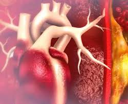 Understanding Arteriosclerosis: The Silent Killer Explained