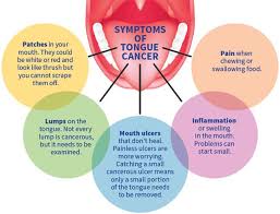 Image result for cancer tongue symptoms)