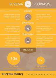 Eczema Vs Psoriasis What S The Difference Psoriasis Psoriasis Causes Eczema