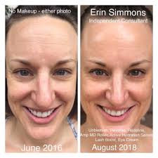 I had terrible acne and I was so self-conscious about it that I wouldn't  even look at myself in the mirror. I hated my skin and felt like everyone  was staring at