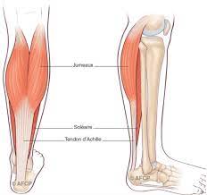 The achilles tendon or heel cord, also known as the calcaneal tendon, is a tendon at the back of the lower leg, and is the thickest in the human body. Tendinite Du Talon D Achille Prevenir Et Traiter Au Naturel Avec L Osteopathe Reflex Osteo
