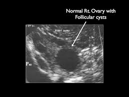 Pin On Ultrasound