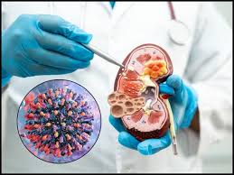 HMPV से क्या किडनी को हो सकता है खतरा? जानें इस बारे में एक्सपर्ट की सलाह  Can kidney be at risk from HMPV Know expert advice, हेल्थ टिप्स - Hindustan