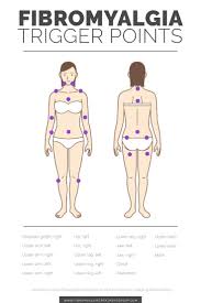 Fibromyalgia Tender Points Trigger Points Fibromyalgia