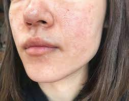 pluest プルエスト 美容 肌 綺麗 スキンケア