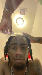 What Can I Do To Stop Ts Bro #fypage #trending #fyppppppppppppppppppppppp  #fy #explore #fy #f #y #viral #viraltiktok #viralvideo #for #you #dandruff