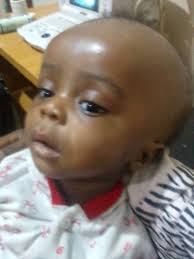 Please Pray With Me For This Innocent Babe Oh Lord Almighty May The Healing  Hands Of the almighty Bring Restoration upon The Life Of this Babe  Amen🙏🙏🙏