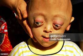 440 New York Veterans Hospital Stock Photos, High-Res Pictures, and Images 