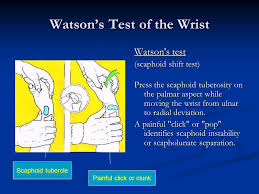 Image result for Scaphoid Shift Test