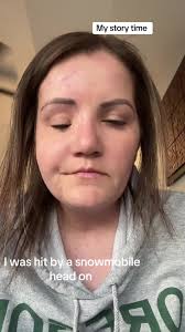 Yall wanted a story time #pov #fyp #ranoverbyasnowmobile #accident #survivor