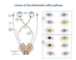 Image result for Optical Reflex