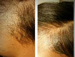 Before And After Dem Edges Tinted Edge Control Natural Hair Styles African American Hairstyles Behind Ear Tattoo