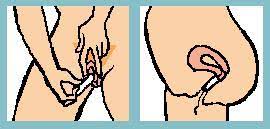 Le commerce propose deux grands types de tampons : Comment Mettre Un Tampon Fil Sante Jeunes