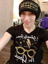 Can high REM sleep be bad for epileptic patients?