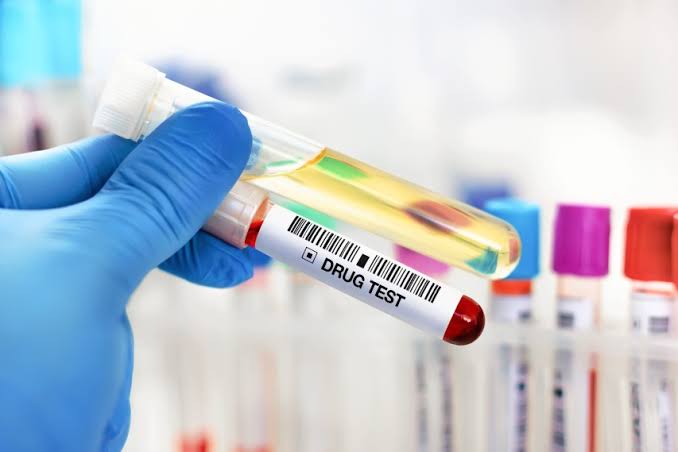 Instant Vs Laboratory Drug Testing For Staying DOT Compliant