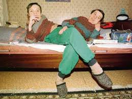 Meski begitu, mereka sama sekali takbahagia. The Heart Breaking Story Of The Most Popular Russian Siamese Twins Mutually