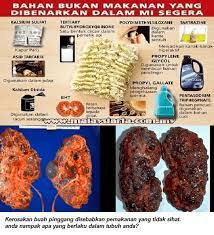 Maggi adalah kegemaran orang ramai di malaysia. Apa Jadi Kalau Selalu Sangat Makan Maggi Korang Kena Baca Ni