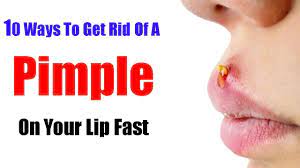Lemon juice to remove pimples on lip: Pimple On Lip Reddit