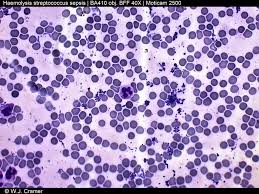 Image result for Streptococcus
