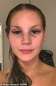 Social worker, 23, who suffered fractured jaw in attack by boyfriend slams  sentence as he walks free