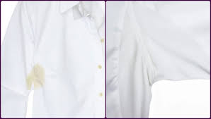 Sari Koltuk Alti Ter Lekesi Nasil Cikar Kadin Halleri