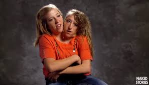 Abby and brittany hensel are conjoined twins who forged successful careers for themselves that emphasizes their individuality and experiences. Mencahot 37a Conjoined Twins Talmudology