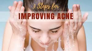 3 STEPS TO IMPROVE YOUR ACNE