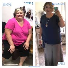 Our Patient Tiffany Shares With Us Her Endobariatric Experience Tiff Did It And You What S Holding You Back Visit Our Website And Reach Your Go Guillermo
