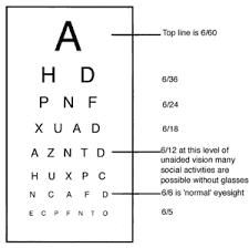 11 Rational Snellen Chart Explained