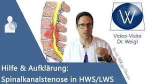 Spinalkanalstenose Schmerztherapie Hochrhein Stephan Bert