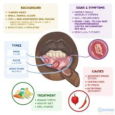 Image result for Canker sores symptoms roof of the mouth