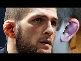 Why do ufc fighters' ears look weird? Preventing Cauliflower Ear In Bjj And Wrestling Jiujitsu News In 2021 Bjj Jiu Jitsu Cauliflower Ear