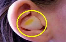 Rawatan alternatif bekam, al fashdu, urut traditional, urut sports. Obati Pusing Hanya Dengan Bawang Putih Ini Caranya Ladies Beauty Fimela Com