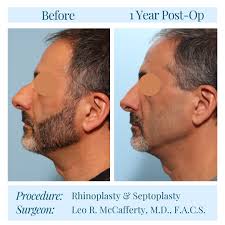 Leo R. McCafferty, MD, FACS & Associates