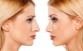 I have a very large hook nose and i was wondering if they would be able to fix it also i have about $3,000 usd saved right now and i could save more once i start working there. Trends In Plastic Surgery In Korea Booking Health