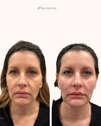 Kelsey Prince DNP, FNP-BC