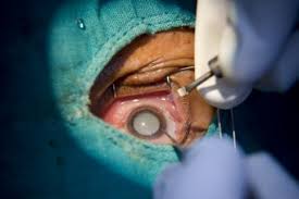 We did not find results for: Cataract Surgery Techniques For Developing Countries