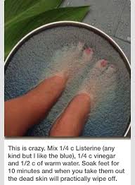 Dead Skin Foot Bath Health And Beauty Tips Feet Care Dead Skin