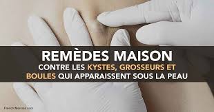 Il y a quelques semaines de ça je découvrais un matin, le lendemain d'un entrainement sportif, que j'avais une petite boule sous la peau au niveau du pectoral gauche. Kyste Sebace Ou Quelque Chose De Plus Grave