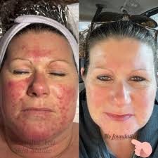 Beautiful You Skin Studio