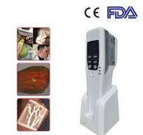Buscador de venas médicas de mano: Vdetector-P2