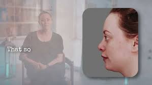 Charles East Reviews: Rhinoplasty London Transformation Stories