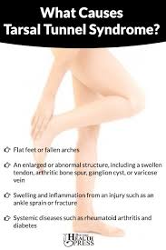 Tarsal Tunnel Syndrome Exercises And Home Remedies Tarsal Tunnel Syndrome Carpal Tunnel Syndrome Syndrome