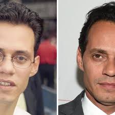 Marc Anthony: Good Genes or Good Docs?!